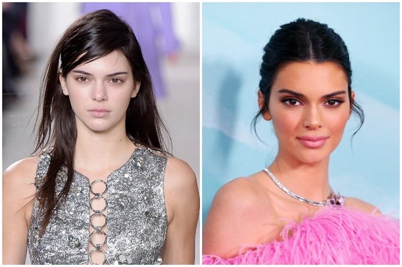 Kendall Jenner