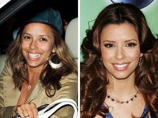 ANTES Y DESPUES (1)