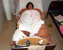 Lo que pasa por Comer mucho....